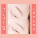 1회 사진기록전 | 구로 붉은눈썹제거 1회차 후기, 미작뷰티 구로점에서 붉은기 정리한 기록