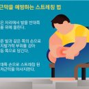 여름 아이템 &#39;쪼리&#39; .. 발가락 기형 만드는 주범 이미지