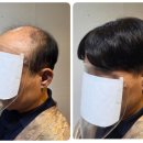 다모아빌딩 서측 도로 | 도봉 창동 맞춤가발 추천