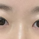 알프스안경위드렌즈 이미지