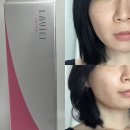 단발머리 | 봉고데기추천 라비엘 봉고데기 34mm 단발머리 사용 후기