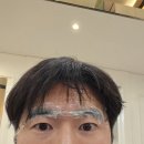 엔젤미의원 | 2년 3개월 만에 다시 찾은 압구정 엔젤미의원, 내 눈썹이 다시 살아났다✨