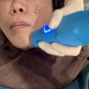 좋은날피부과의원 | 압구정역피부과, 아르나의원 안아픈 울쎄라 쿨소닉 내돈내산 후기(통증, 전후비교, 효과)