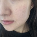 메디포인트 | 메디시드 기미진 화이트닝크림 솔직후기