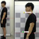 비전동 소로 3-41 | 평택 거북목, 굽은등 정렬이 바뀌어야 통증이 줄어듭니다