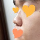 컴플렉스케어 이미지