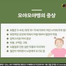 모야모야병 증상 원인 치료 총정리! 아이에게 나타나는 신호는? 이미지
