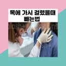 법인두가시