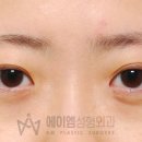 에이엠성형외과의원 이미지