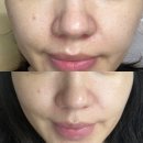 모공부자의 클린포엘 포어낫 모공 앰플 솔직후기(올리브영 추천템)
