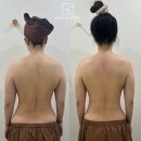 구래동 등관리, 무식하게 강한 마사지 받지 마세요