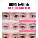 세미성형외과의원 이미지