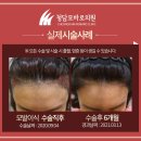 청담모바로의원 이미지