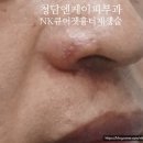 청담엔케이피부과청담NK피부과 이미지