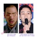 논산두피관리 M자형탈모앞머리 헤어스타일, 소개팅룩추천(ft.탈모관리후기)