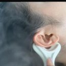 에그뮤즈 스킨스칼프 이미지