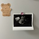 도안누리여성의원 | 대전 산부인과 도안누리여성의원 방문하기 임신6주 7주차 난황 심장소리 초기증상 입덧