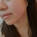 대명주유소 | 뷰티｜안양피부관리 고귀한에스테틱 / 작은얼굴 관리+하이푸 케어 후기