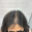 두피움 이미지
