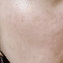 필앤필 | 얼굴각질제거 꿀템 아이소브 나이트 앤 필 크림 리얼 후기