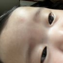 (주)스캔코 | 25년 10월 다섯째주~11월 첫째주 일상/139일-146일 아기 육아일기/ 4개월 아기 두상교정