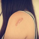 레노메디 이미지