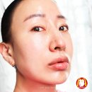 메디센스 이미지