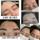 돕스칼프