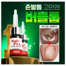 미라클 네일