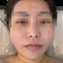 예화 에스테틱 이미지