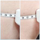 리바디핏 | 청라다이어트 체형관리 라인 정리 리바디라인 Before &amp; After 후기