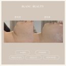 슈어왁싱&에스테틱 | 이중턱이 고민이라면 김해피부관리 블랑뷰티