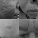 청담모델성형외과의원 이미지