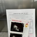 전주시보건소 | 전주시보건소 임산부 등록하고 엽산이랑 임산부뱃지 받은 후기