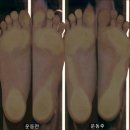 바른척추운동처방센터