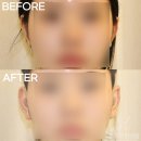 르에이치의원 이미지