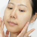 한빛나노의료기기 | 로딕 에어부스터 2주 후기 트러블성 피부를 위한 리커버리 뷰티디바이스