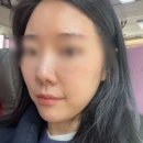 화메디 | 위례 스킨케어 스킨스타 위례점 연예인 피부관리 30% 할인 꿀팁