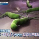 위 건강에 좋은 5가지 식품 이미지
