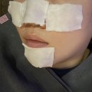 트리메드 이미지