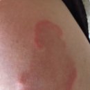 (주)바른큐 이미지