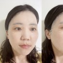 오드랩 | 오비오드 비타C멜라리스글로우토닝마스크 민감피부도 안심! 미백마스크 추천