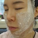 분동 | 신사역피부과 베이비리프팅 실리프팅후기