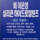 렌즈스토리천안