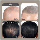 타브가 | 일산 두피문신 모타브가 압도적인 이유