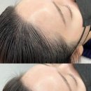 진헤어라인 이미지