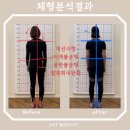 제주 체형교정 재활전문 제이엠티바디핏