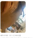 정청신경정신과 네이버블로그