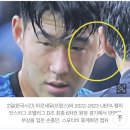 토트넘 “손흥민, 얼굴 골절 수술후 재활”…월드컵 비상 이미지