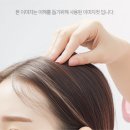 리즈모의원 | 하단 비절개 모발이식 잘하는곳 기준이 되는것들은?